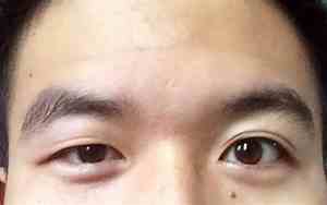 男人眼睛凸大的面相图片